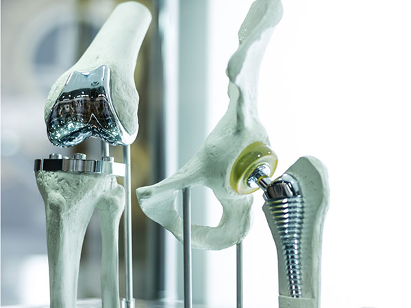 Arthrose Knieprothese Prothese Therapie