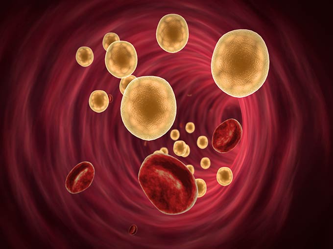 Cholesterin Funktion Blutkreislauf Körper Blutfette
