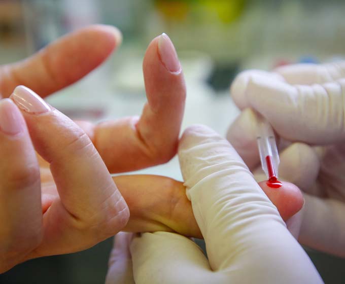 Finger Blutprobe Blut Insulin Hand