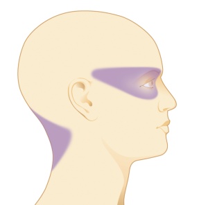 Migräne Aura Kopfschmerzen