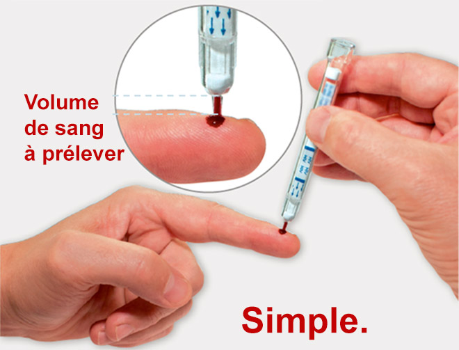 Selbsttest Bluttropfen AIDS Test