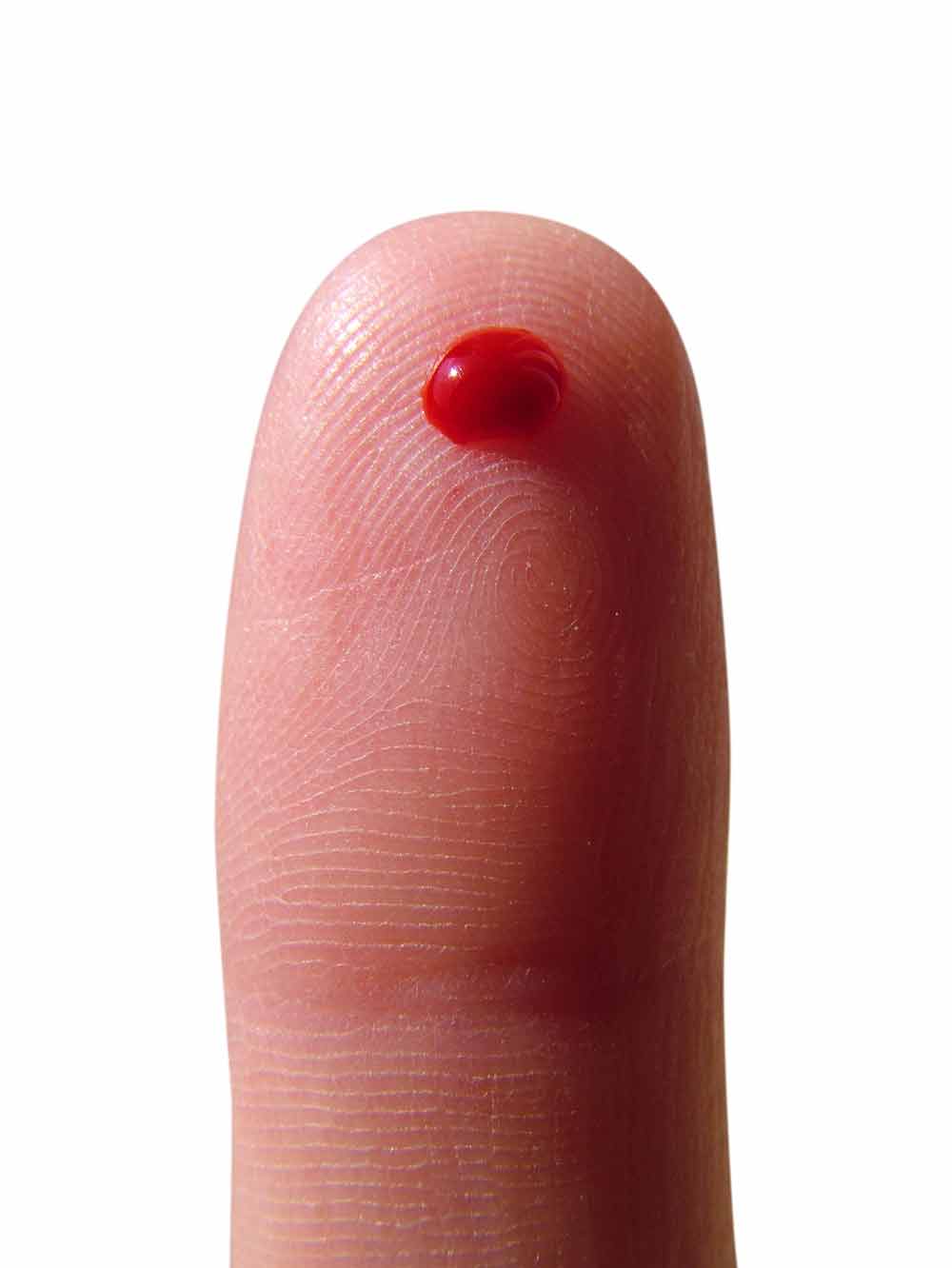 Finger Blut Schnelltest HIV